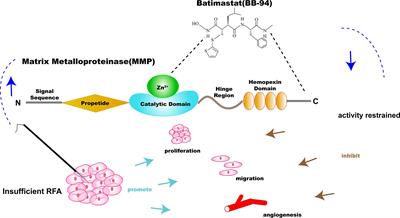 Specific Inhibitor of Matrix Metalloproteinase Decreases Tumor Invasiveness After Radiofrequency Ablation in Liver Tumor Animal Model